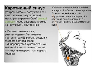 Каротидный синес