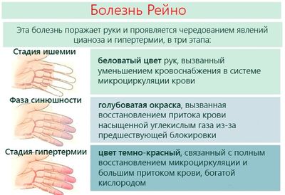 Вазоспастическое заболевание