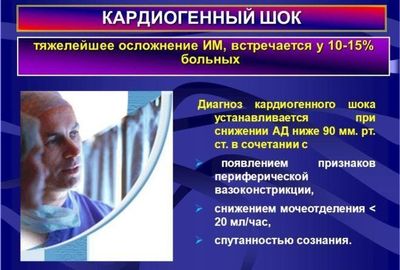 Осложнение инфаркта миокарда