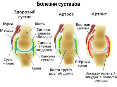 Схематический рисунок