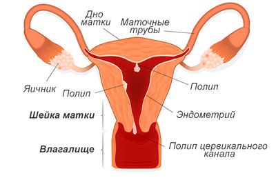 длительные месячные