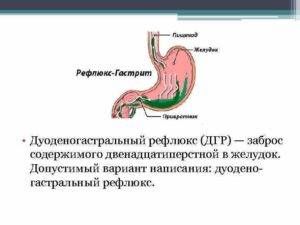 Дуодено-гастральный рефлюкс