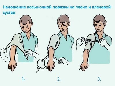 Пункты фиксации
