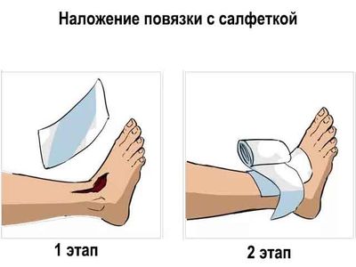 Обеззараживающая салфетка