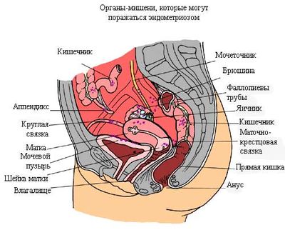 Физиолечение при эндометриозе