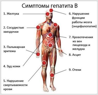 как распознать гепатит B