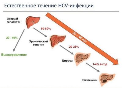Почему опасен 3 генотип гепатита С и можно ли от него избавиться
