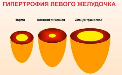 Виды ГЛЖ