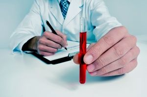Холестерин ниже нормы: причины, опасность снижения и методы повышения