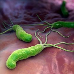H. pylori