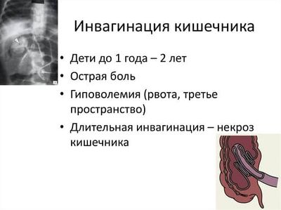 Симптомы