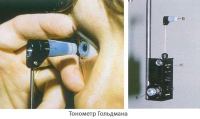 Тонометр Гольдмана