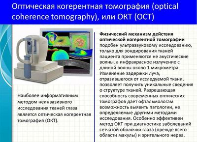 Оптическая когерентная томография