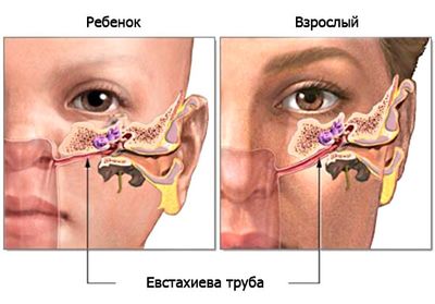 Для лечения насморка у детей следует использовать капли, чтобы не вызвать воспаление прилежащих полостей...