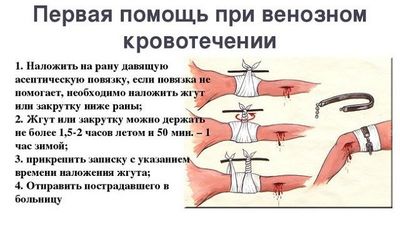 Перевязывание при венозном кровотечении