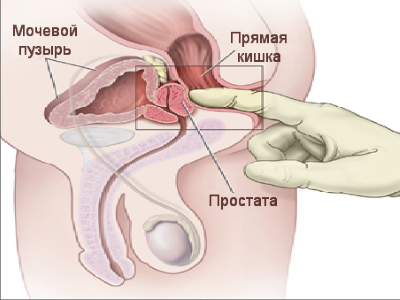 простата