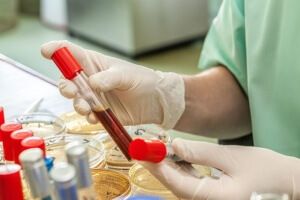 БАК – эффективная диагностика заболеваний печени