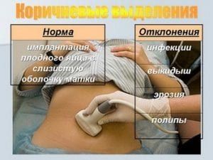 Коричневые выделения при беременности на ранних сроках: с и без запаха