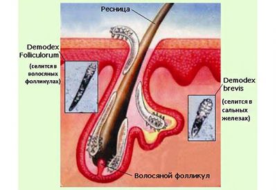 Клещ Демодекс
