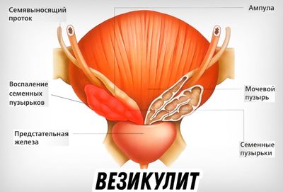 Почему во время секса у мужчин идет кровь из полового органа - причины и общие рекомендации пациентам