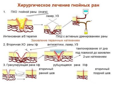 Хирургическое лечение травмы