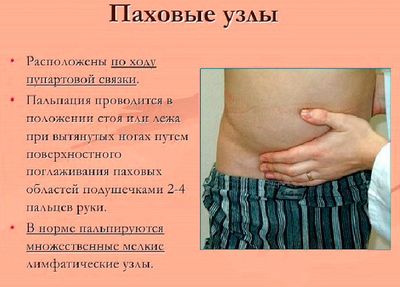 Паховые узлы