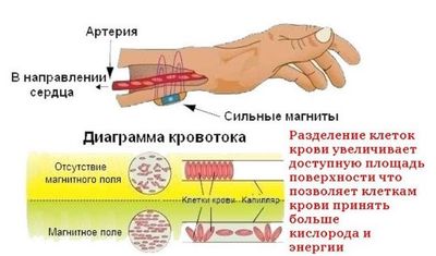 Принцип работы магнитного браслета