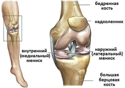 Что такое мениск коленного сустава и как лечить его разрывы
