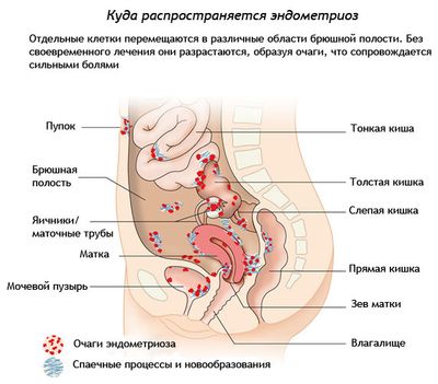 Менструация при Визанне