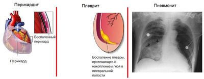 Осложнения