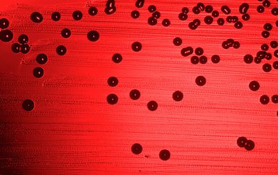 Гемофильная палочка Haemophilus influenzae