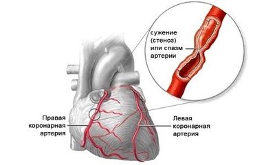 Настойка водяного перца при месячных