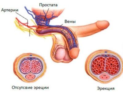 эрекция