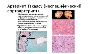 Классификация