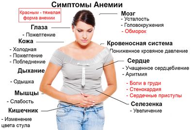 Симптомы анемии