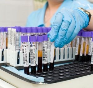 Причины понижения уровня амилазы в крови