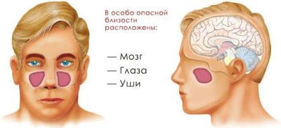 Осложнения гайморита могут отразиться на следующих органах