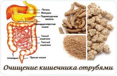 Высевка в борьбе с запорами