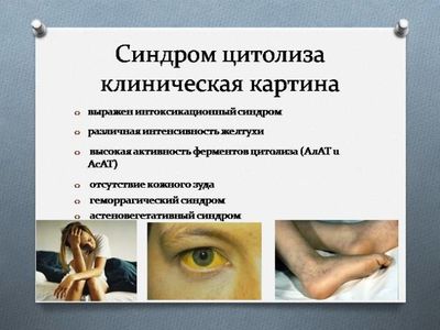 Клиническая картина при синдроме цитолиза