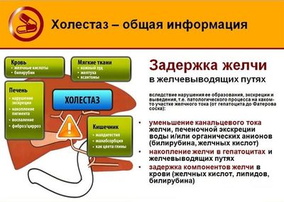 Холестаз