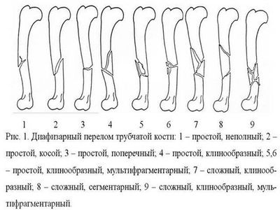 Типы повреждений