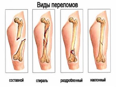 Классификация повреждений