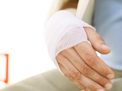 Чем опасен и как лечить перелом плечевой кости