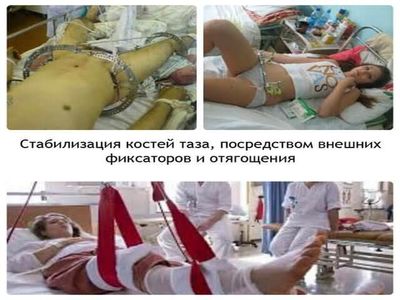 Хирургическое лечение травмы