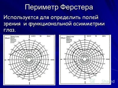 Кинетическая периметрия