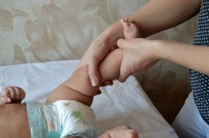 Лечение плоско-вальгусной деформации