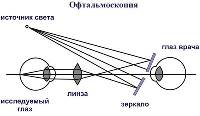 Как проводится офтальмоскопия