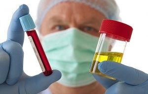 От чего появляется кровь в моче у мужчин
