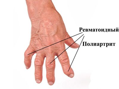 Схематический рисунок