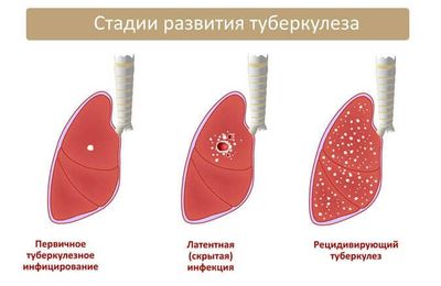Стадии